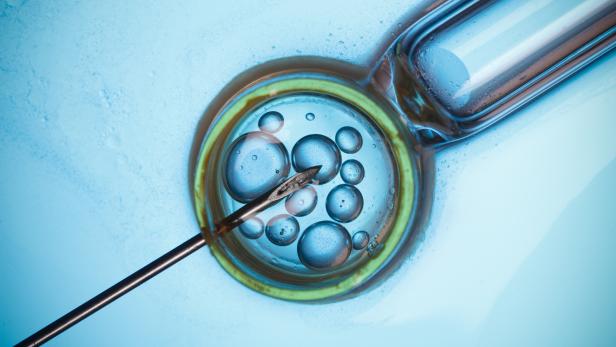 Microscopic research or IVF concept