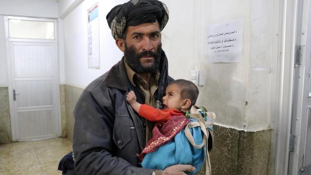 Unterernährtes Kind in Afghanistan