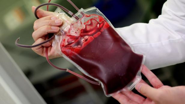 Eine Blutkonserve, aufgenommen am Dienstag (25.08.2009) in einem Labor der Uniklinik Aachen. Nach Einschätzungen von Experten kommen von den rund zwei Millionen regelmäßigen Blutspendern in den nächsten Jahren viele altersbedingt nicht mehr infrage. Deshalb müsse man um Nachwuchs werben, stellte die Bundeszentrale für Gesundheitliche Aufklärung (BZgA) nun am Rande einer bundesweiten Nachwuchs-Werbekampagne fest. In Deutschland werden nach BZgA-Angaben täglich 15 000 Blutspenden für Schwerkranke, Unfallopfer und Operationen gebraucht. Foto: Felix Heyder dpa/lnw +++(c) dpa - Bildfunk+++