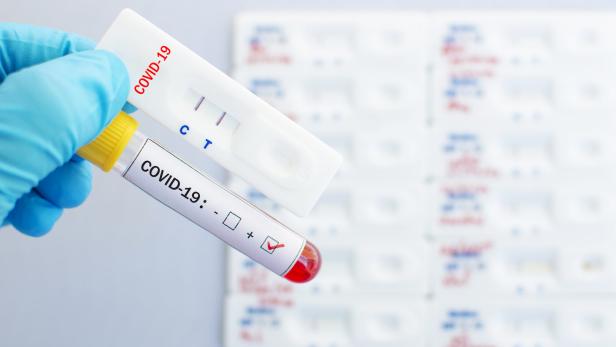 Corona-Virus: Wo Antigen-Tests gute Dienste tun