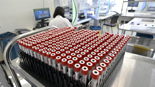 Großes Fragezeichen hinter den PCR-Test-Kapazitäten