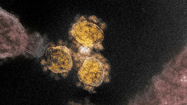 Hier zu sehen: Eine Transmissionselektronenmikroskop-Aufnahme von SARS-CoV-2, jenem Virus, das Covid-19 verursacht.