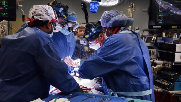 First-of-its-kind heart transplant surgery in the US