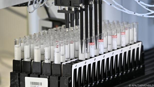 Tests am dritten Tag würden knappe PCR-Kapazitäten weiter belasten