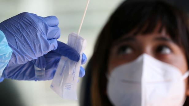 Epidemiologe zu Corona-Tests: „Derzeit gibt es keine Teststrategie“