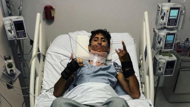 Schreckliche Diagnose: Rad-Star Bernal hat 20 gebrochene Knochen