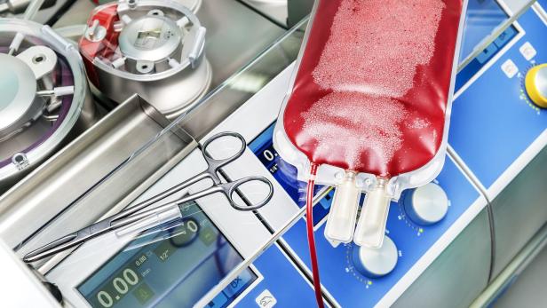 Eltern forderten Blut von Ungeimpften für Herz-OP ihren Kindes
