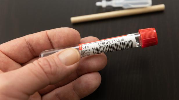 Eine Hand hält ein Reagenzglas für einen PCR-Test.