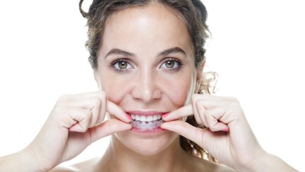 DrSmile und Co: Können Zahnschienen ohne Zahnarzt funktionieren?