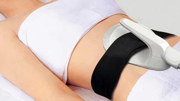 Eine Frau erhält eine nicht-invasive Behandlung zur Fettreduktion am Bauch.