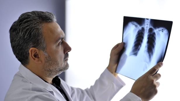 Corona: Risiko für Lungenveränderungen bei Männern über 60