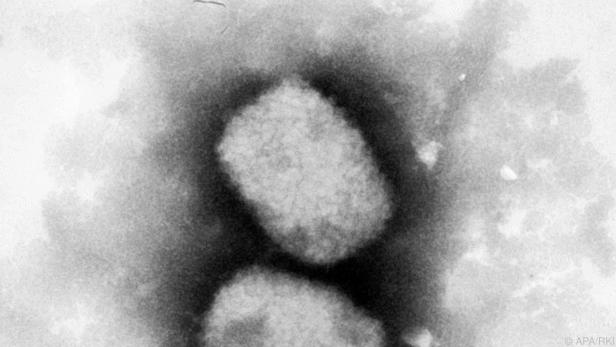Das Affenpocken-Virus geht um und sorgt für Quarantäne-Empfehlungen