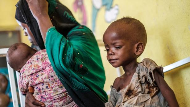 UNO warnt: 10.000 Kindern in Afrika droht Hungertod