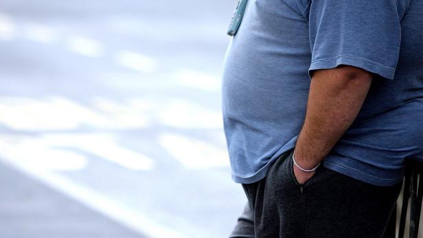 Rund, ung’sund – und teuer: Der Staat leidet an Übergewicht