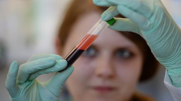 Test aus Österreich kann Corona-Immunität ohne Antikörper bestimmen