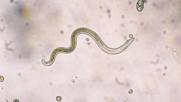 Gesund alt werden: Die Wissenschaft lernt von Würmern
