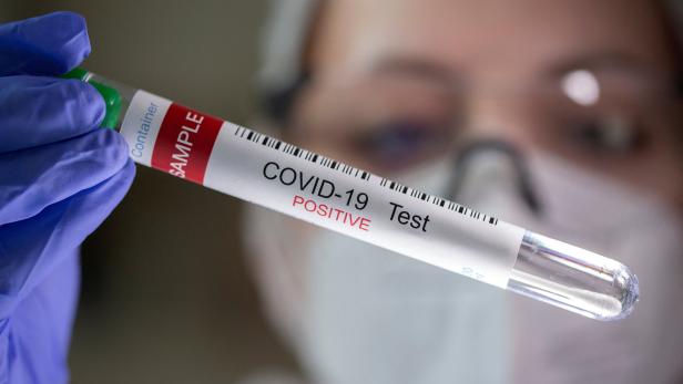Corona: Bis zu 2.000 Covid-Patienten in Spitälern befürchtet