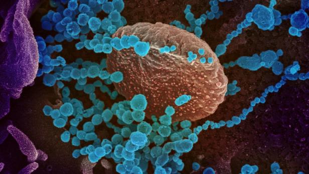 Coronaviren (blau) verlassen im Labor infizierte Zellen. Derzeit ist das Infektionsniveau extrem niedrig, der Sommer wird ruhig bleiben.