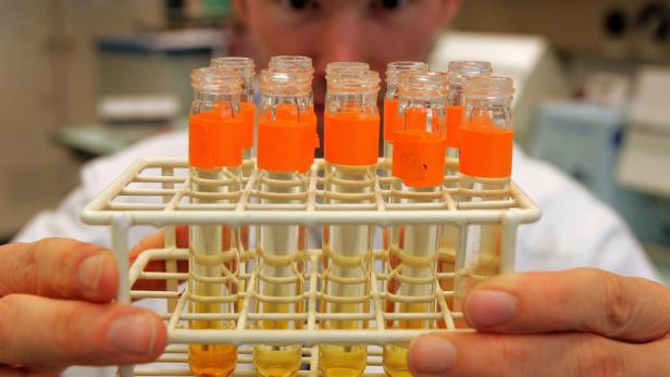 WADA: 27 Dopingfälle in Österreich