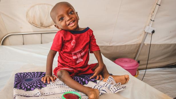 Ja’far teilt sein Lächeln mit uns. Im Nordwesten Nigerias betreiben wir 10 stationäre und 34 ambulante Ernährungszentren, wo wir akut und schwer mangelernährte Kinder behandeln.
