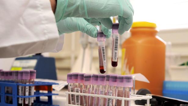 WADA-Chef Howman kritisiert sinkende Zuschüsse