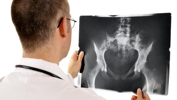 Jede dritte Röntgenuntersuchung nicht gerechtfertigt