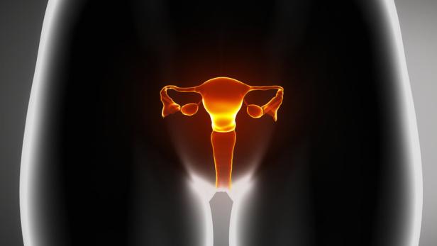 46-55697575 Zunahme bei Frauen ab 65, die an Gebärmutterhalskrebs sterben