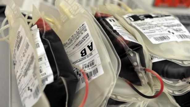 Anti-Doping-Agentur will mehr Bluttests