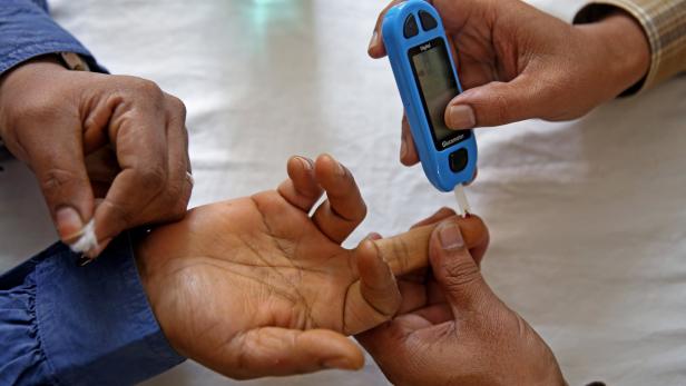 Forscher untersuchten, ob Covid-19 auch Diabetes auslösen kann