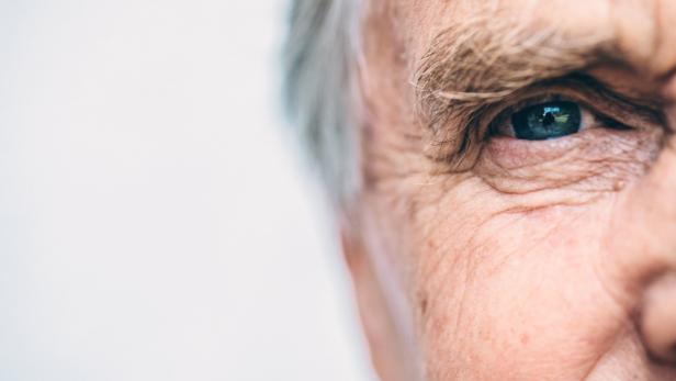 83-jähriger Blinder kann nach OP-Weltpremiere in Italien wieder sehen