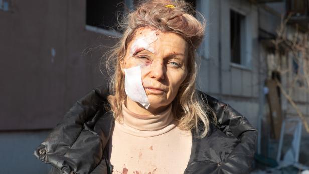 Ukraine: Bereits mehr tote Zivilisten pro Jahr als im Irak-Krieg