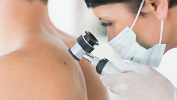 Hautkrebs: Warum nach der Pandemie die Vorsorge besonders wichtig ist