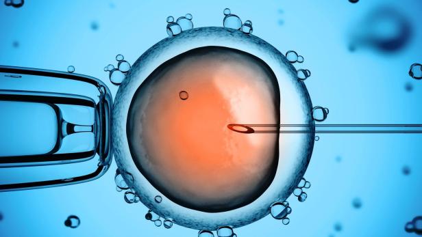 Bei einer intrazytoplasmatischen Spermieninjektion (ICSI) wird eine einzelne Samenzelle mit einer sehr feinen Nadel direkt in eine Eizelle eingeführt (injiziert). Erstmals wurde die Nadel von einem Roboter gesteuert.