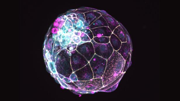 Ein Embryo-Modell (Blastoid) aus Stammzellen, entwickelt vom Team um Nicolas Rivron am Wiener IMBA-Institut.