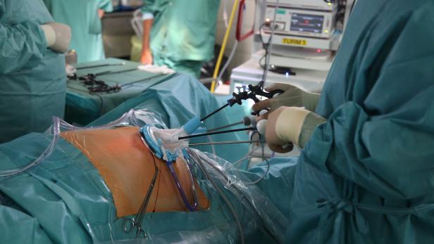 Engpässe: Anästhesisten dürfen 55 Stunden arbeiten