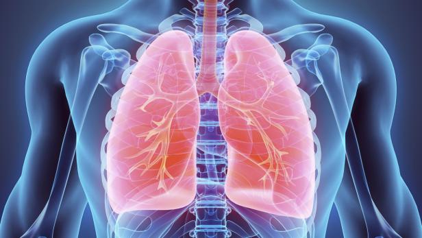 Die Sauerstoffaufnahme über die Lungenbläschen kann beeinträchtigt werden.