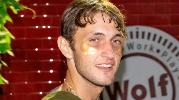 Anwar Hadid mit goldenen Augenpads.