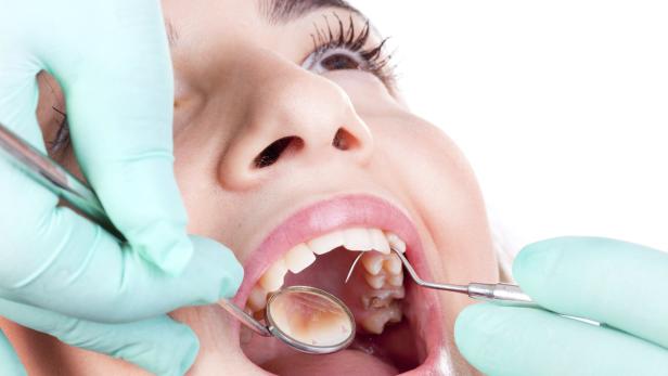Welche Folgen die Angst vorm Zahnarzt haben kann