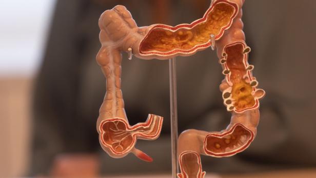 Ein anatomisches Modell eines menschlichen Dickdarms mit sichtbarem Querschnitt und inneren Strukturen.