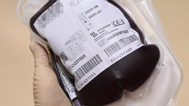Wegen Baustelle: Gravierende Engpässe bei Blutspenden
