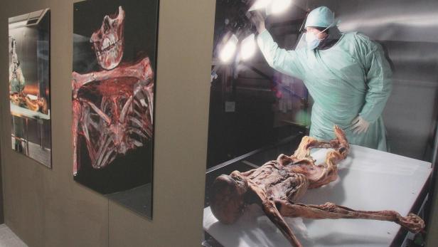 Ein Wissenschaftler untersucht die Mumie „Ötzi“ in einer Ausstellung.