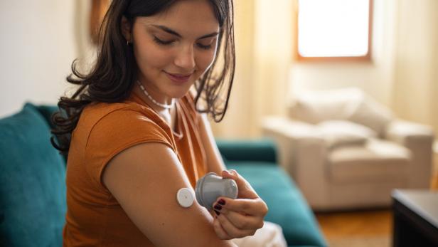 Eine junge Frau bringt einen Glucose-Sensor an ihrem Oberarm an.