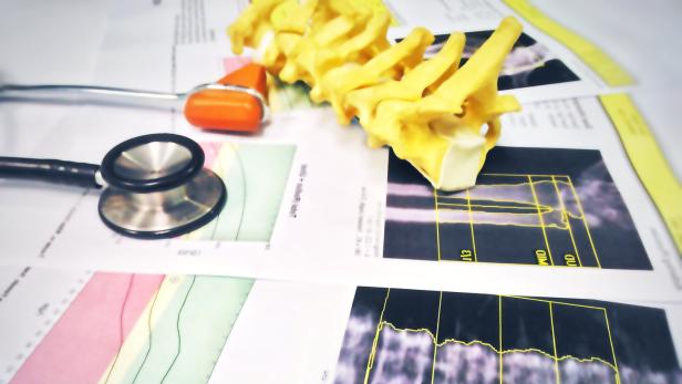 Ein Modell einer Wirbelsäule, ein Stethoskop und ein Reflexhammer liegen auf medizinischen Ausdrucken mit Diagrammen.