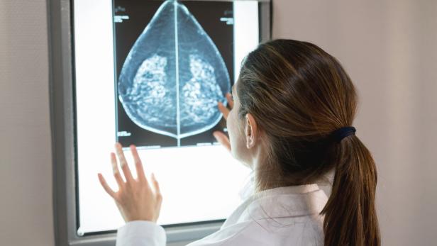Frau begutachtet Bilder einer Mammografie