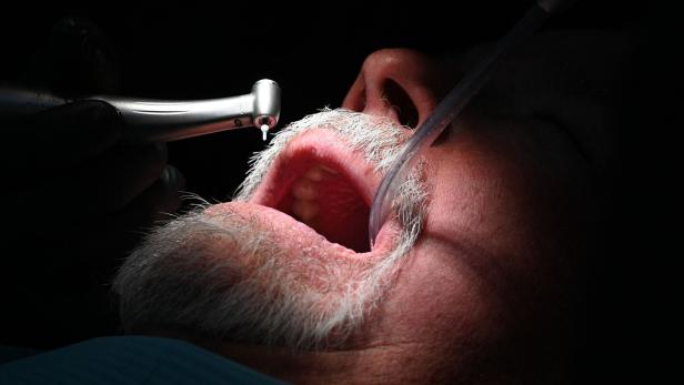 Zahnarzt bohrte Patient Schraube in Gehirn