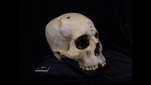 Schädel und Unterkiefer aus der Zeit zwischen 2687 und 2345 v. Chr. – wohl von einem männlichen Individuum im Alter von 30 bis 35 Jahren.