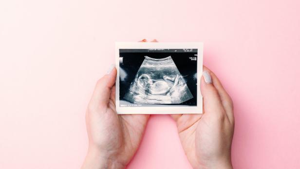 Eine Frau hält ein Ultraschallbild eines Babys in Händen.