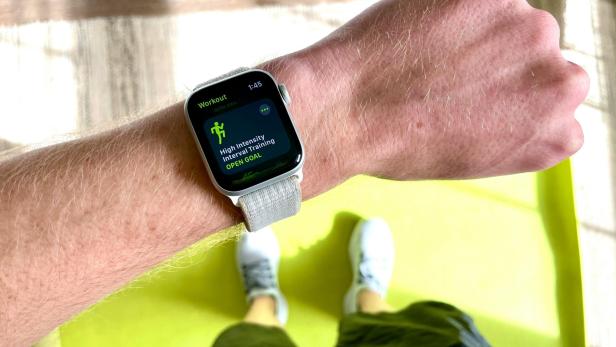„Erster Bilder der Apple Watch X geleakt“.