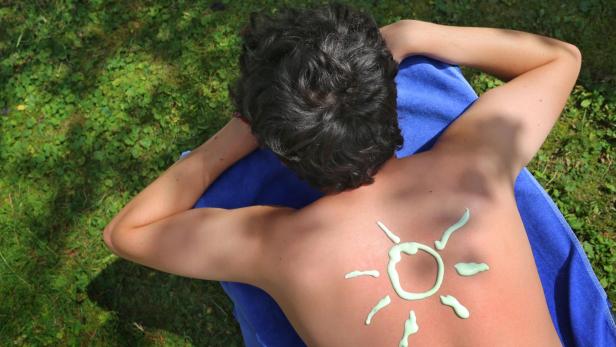Sonnenbrand: Welche Hausmittel wirklich wirken
