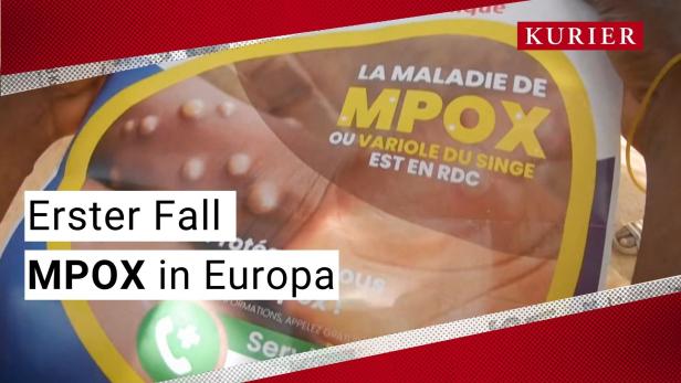 Mpox: Erster Fall außerhalb Afrikas entdeckt